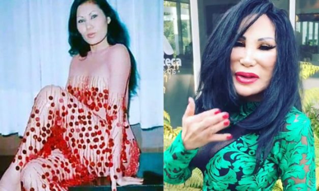 Así era Lyn May antes del tratamiento que le transformó la cara (FOTOS)